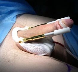 How is the action to increase the penis